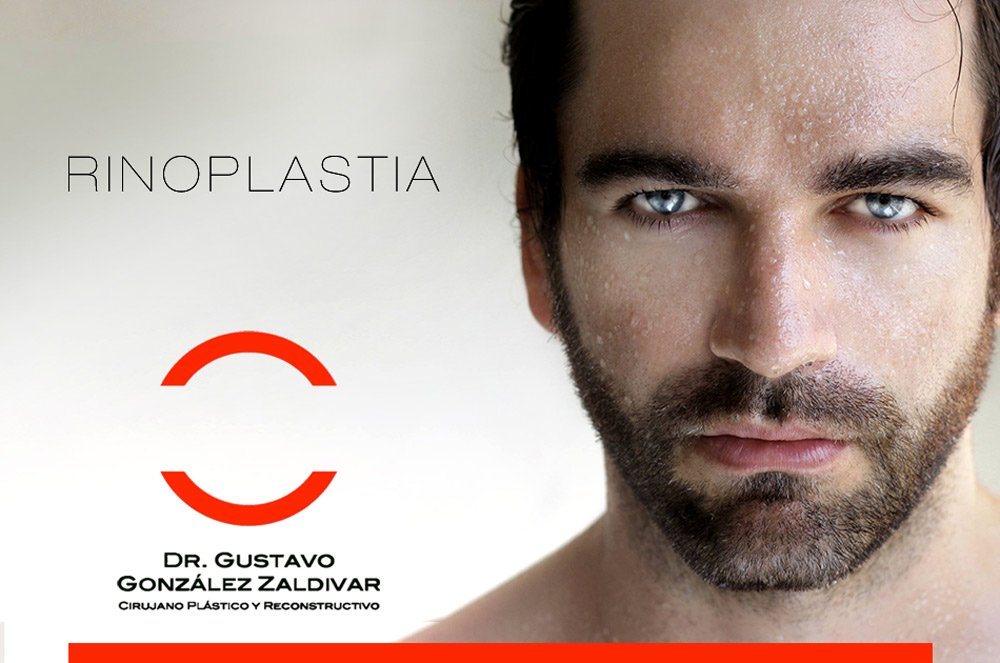 Campaña Estética Redes Sociales